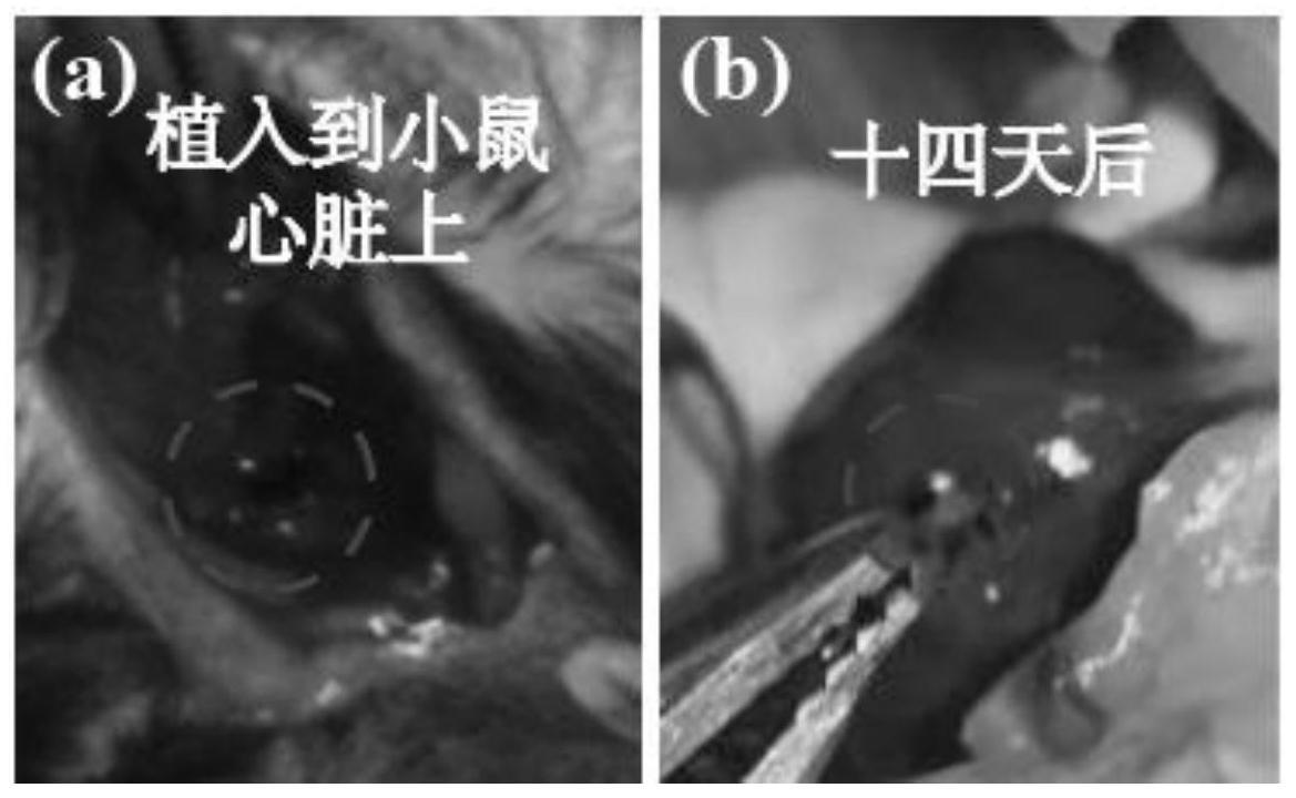 超级电容器及其制备方法、植入方法和可植入电子医疗设备