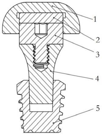 一种颌面赝复体固位用磁附着固位装置的制作方法