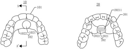 矫正系统的制作方法