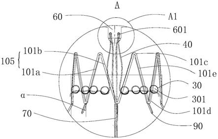 覆膜支架系统及其覆膜支架的制作方法