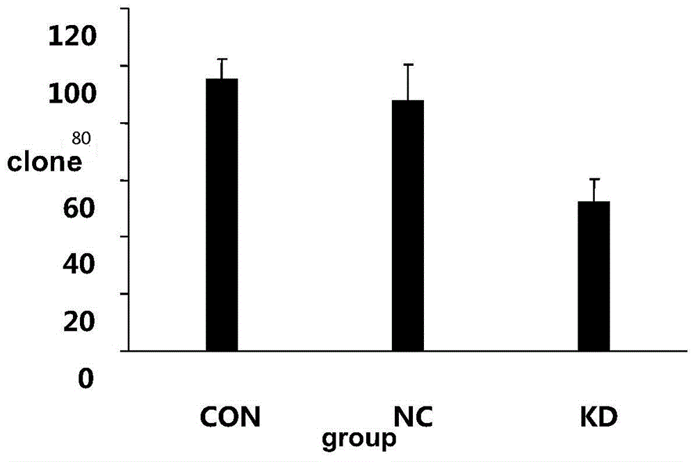 一种人AP-2α基因的shRNA干扰序列及其制备与应用的制作方法