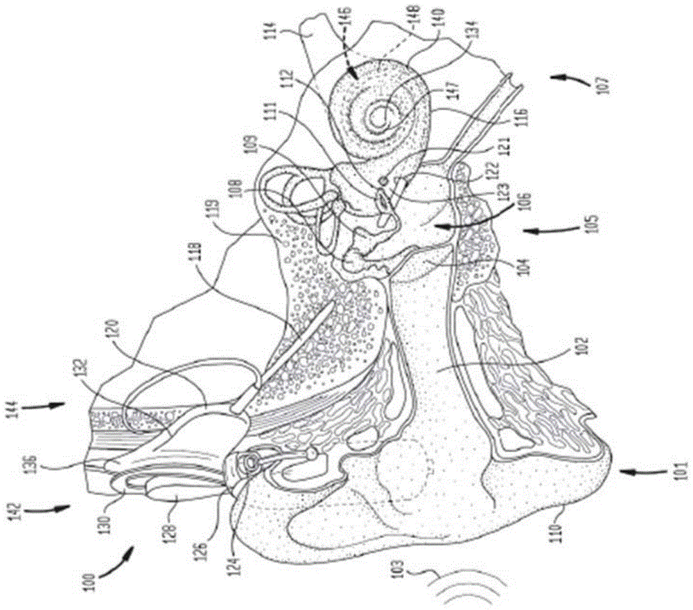 用于自主启用听觉假体的系统和方法与流程
