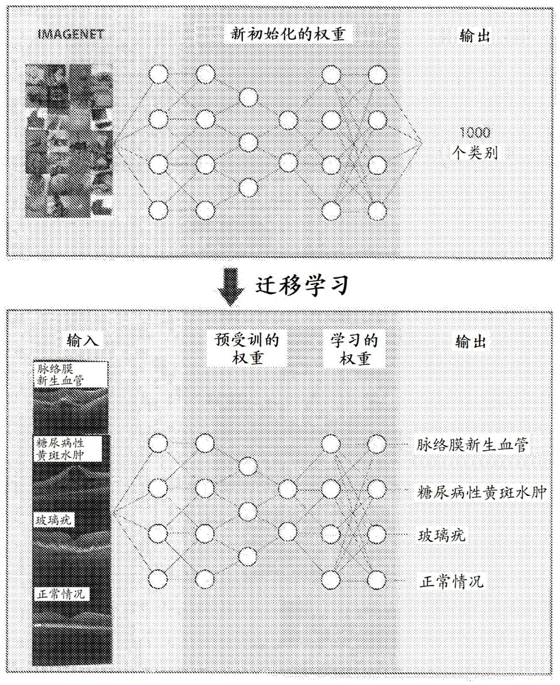 眼科疾病和病症的基于深度学习的诊断和转诊的制作方法