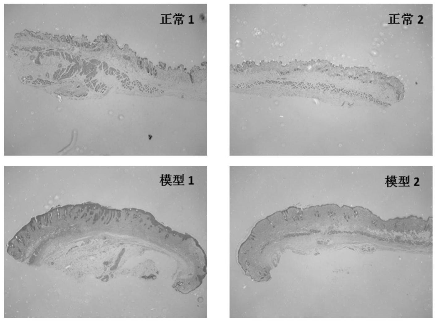 皮肤增生性瘢痕动物模型及其构建方法与流程