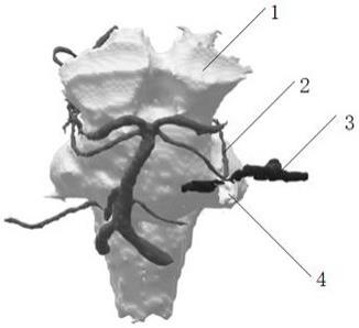 一种基于MR图像的三叉神经痛模型及其制备方法与流程