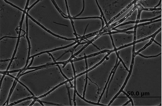 一种炭角菌科真菌sj18及其在松材线虫防治上的应用的制作方法