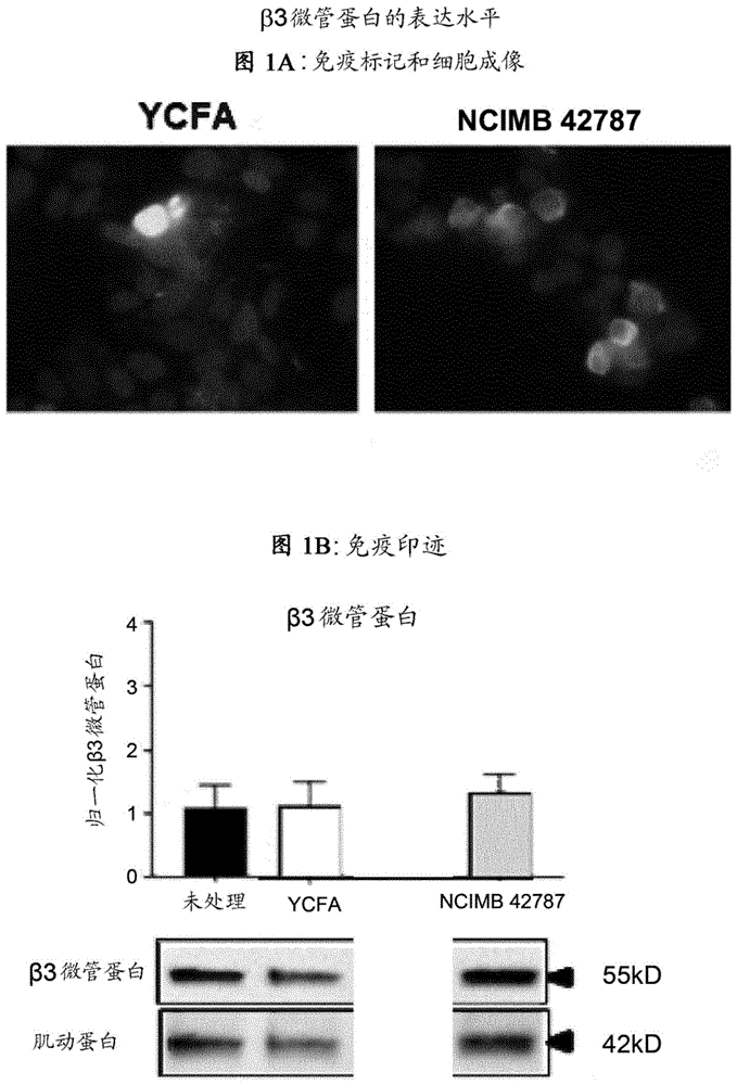 包含细菌菌株的组合物的制作方法