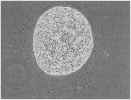 一种诱导人间充质干细胞成软骨分化培养基及其制备方法与流程