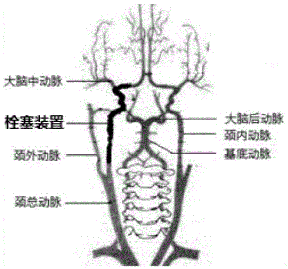 用于建立血管栓塞动物模型的装置的制作方法