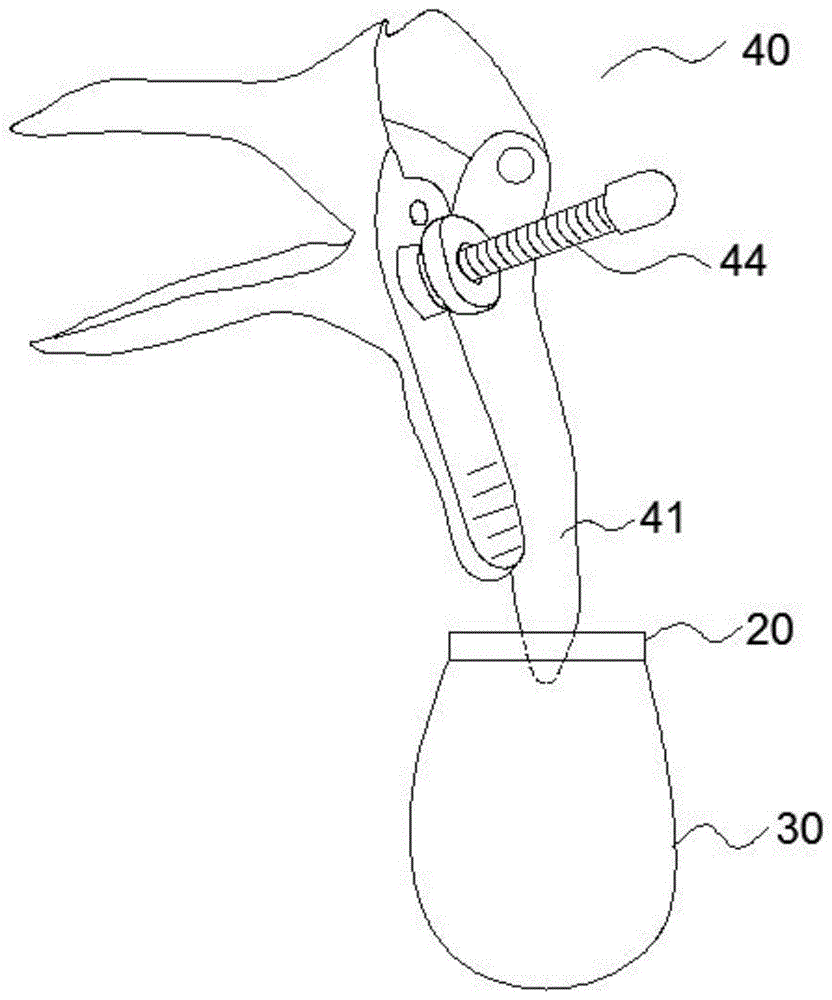 一种病变组织的承接器的制作方法