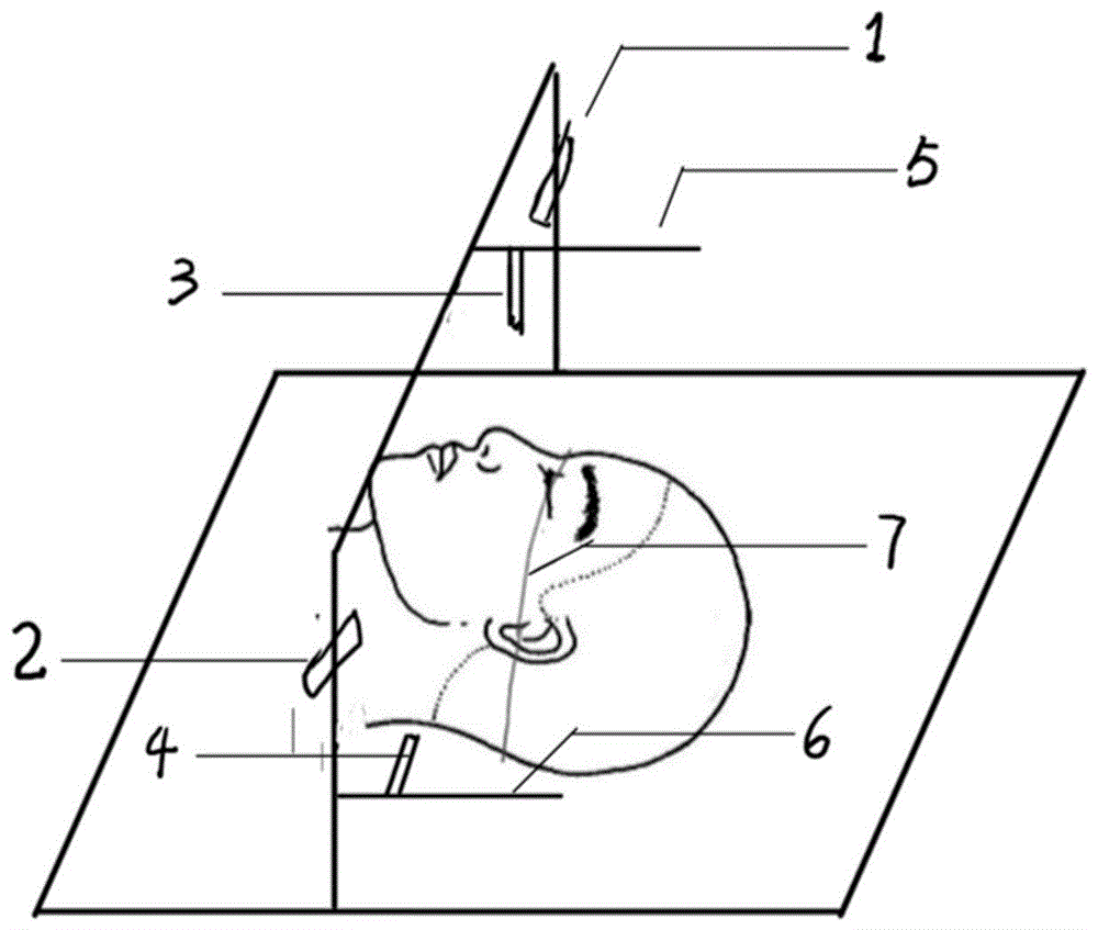 激光定位框架结构的制作方法