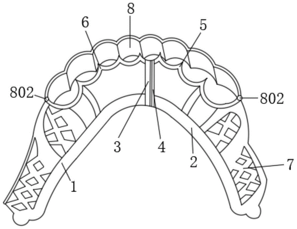 一种新型义齿种植支架的制作方法