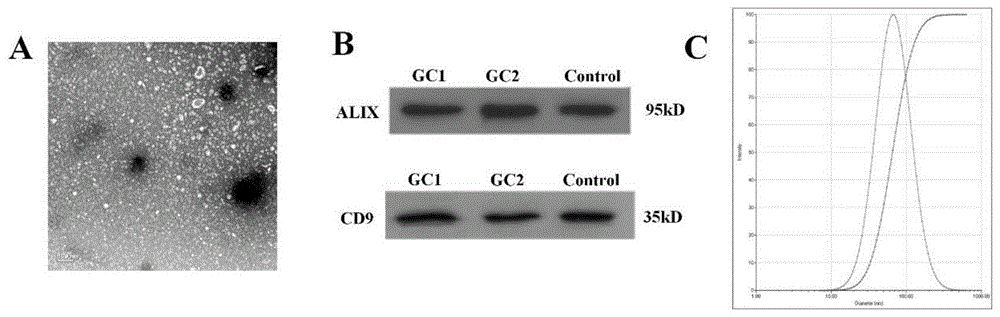 一种外泌体circRNA PVT1的用途