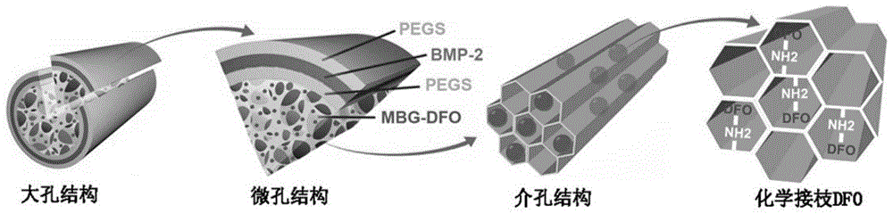 DFO和rhBMP-2协同激发成骨的复合支架及其制备方法和应用