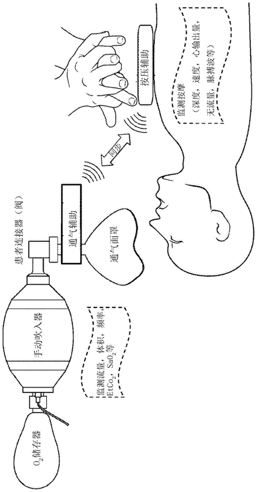 用于进行紧急护理程序的辅助设备、用于同步心肺复苏的辅助系统及相关方法与流程