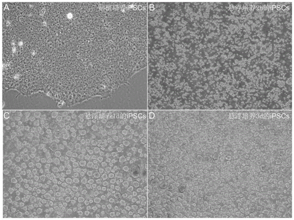 一种诱导多能干细胞定向分化制备胰岛β细胞的培养方法与流程