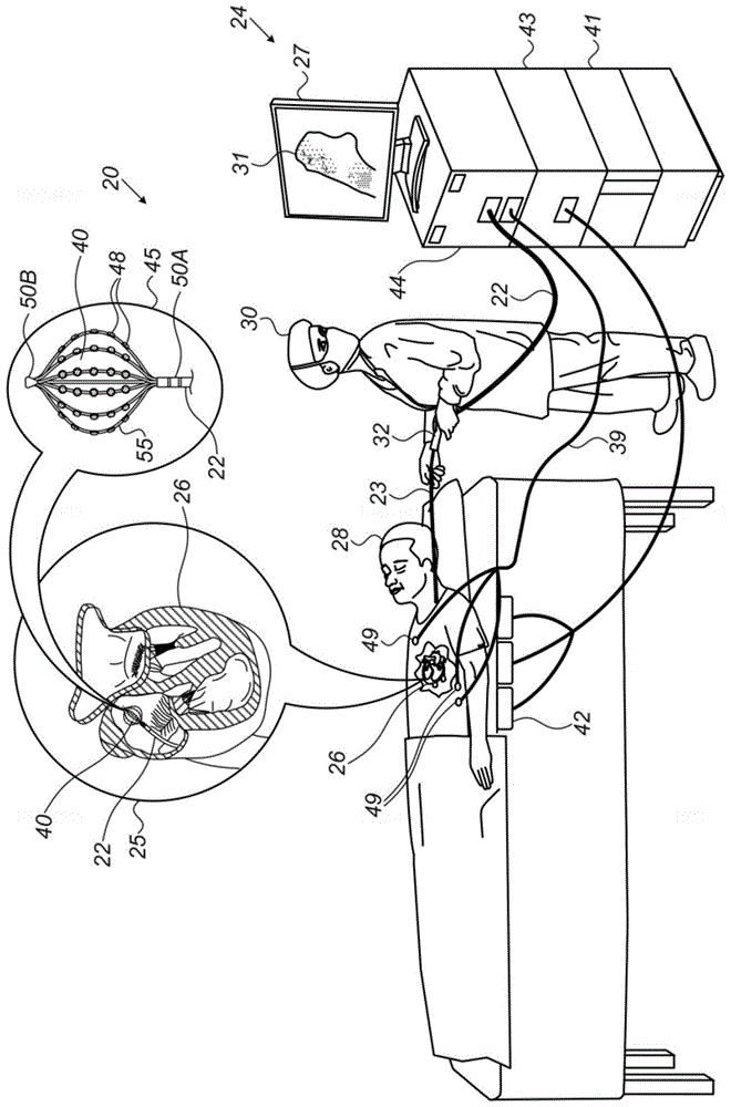 电生理参数的自动图形呈现的制作方法