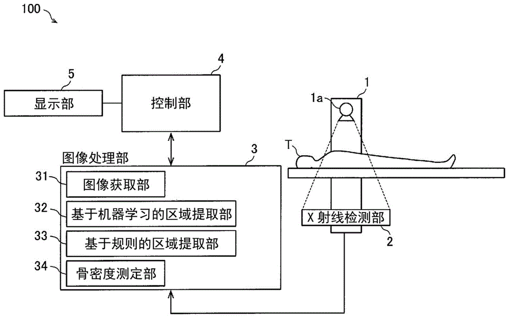 X射线摄像装置的制作方法