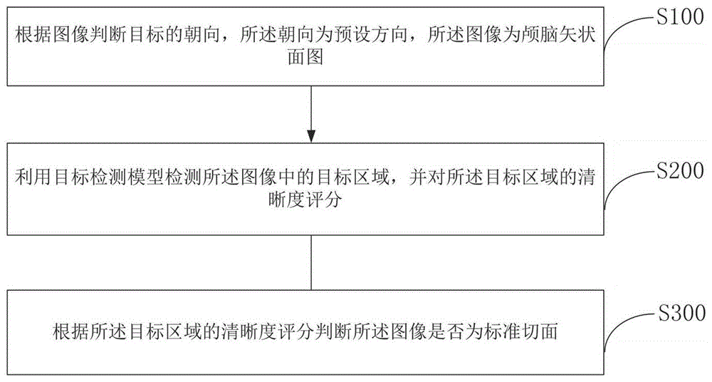 图像标准切面的处理方法及装置与流程