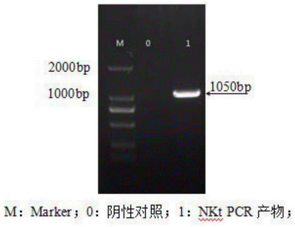 一株含突变纳豆激酶重组基因的工程菌及其构建方法和应用