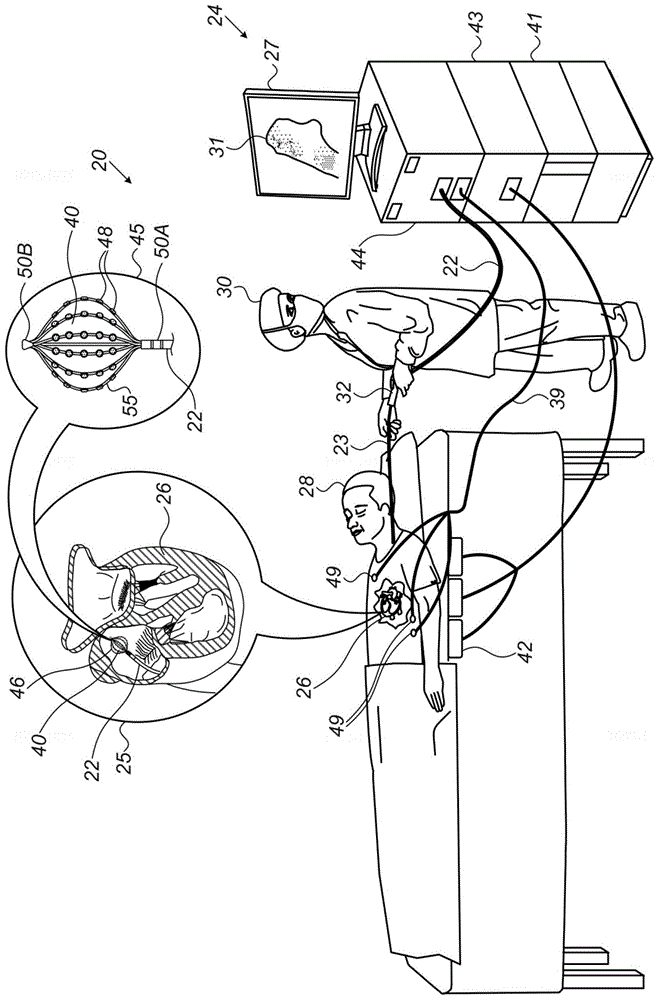 电生理参数的双选图形呈现的制作方法