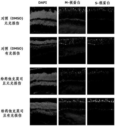 视网膜和/或光感受相关症状的改善或预防用药物、以及改善或预防视网膜和/或光感受相关症状的物质的筛选方法