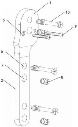 一种加固型股骨近端锁定板的制作方法