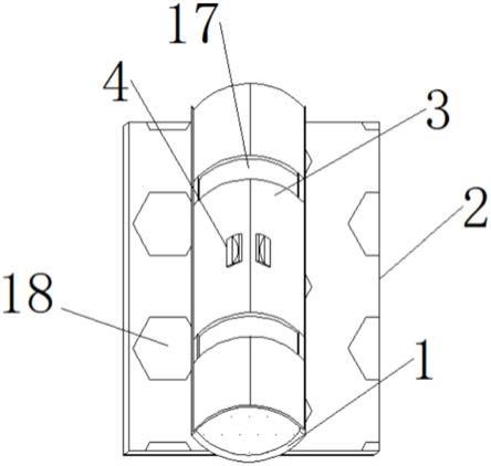 一种血透患者颈部临时插管固定装置的制作方法