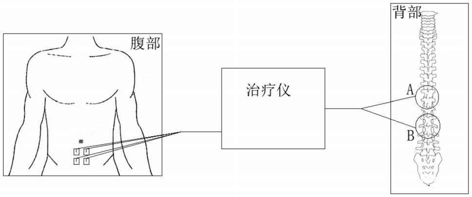 一种电、磁刺激仪及其使用方法与流程