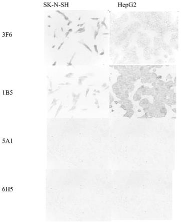 一种检测alpha-synuclein蛋白的鼠单克隆抗体及其应用的制作方法