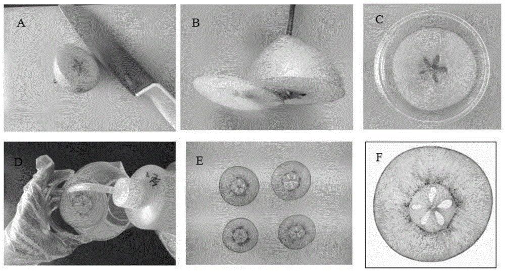 一种可视化半定量快速评价梨果石细胞的方法