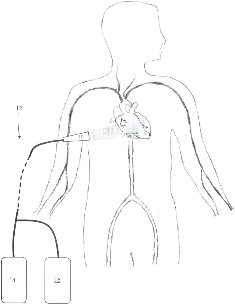 体外光声扫描仪的制作方法