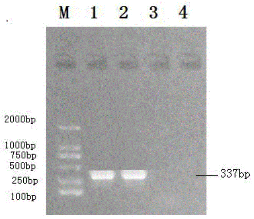 一种用于猪德尔塔冠状病毒巢式RT-PCR检测的引物组和试剂盒的制作方法