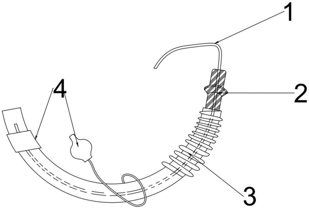 一种螺旋可收缩管型单腔气管导管的制作方法