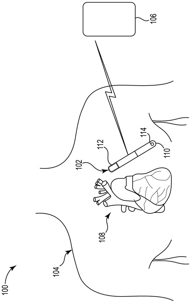 X射线ID标签氢吸气剂的制作方法