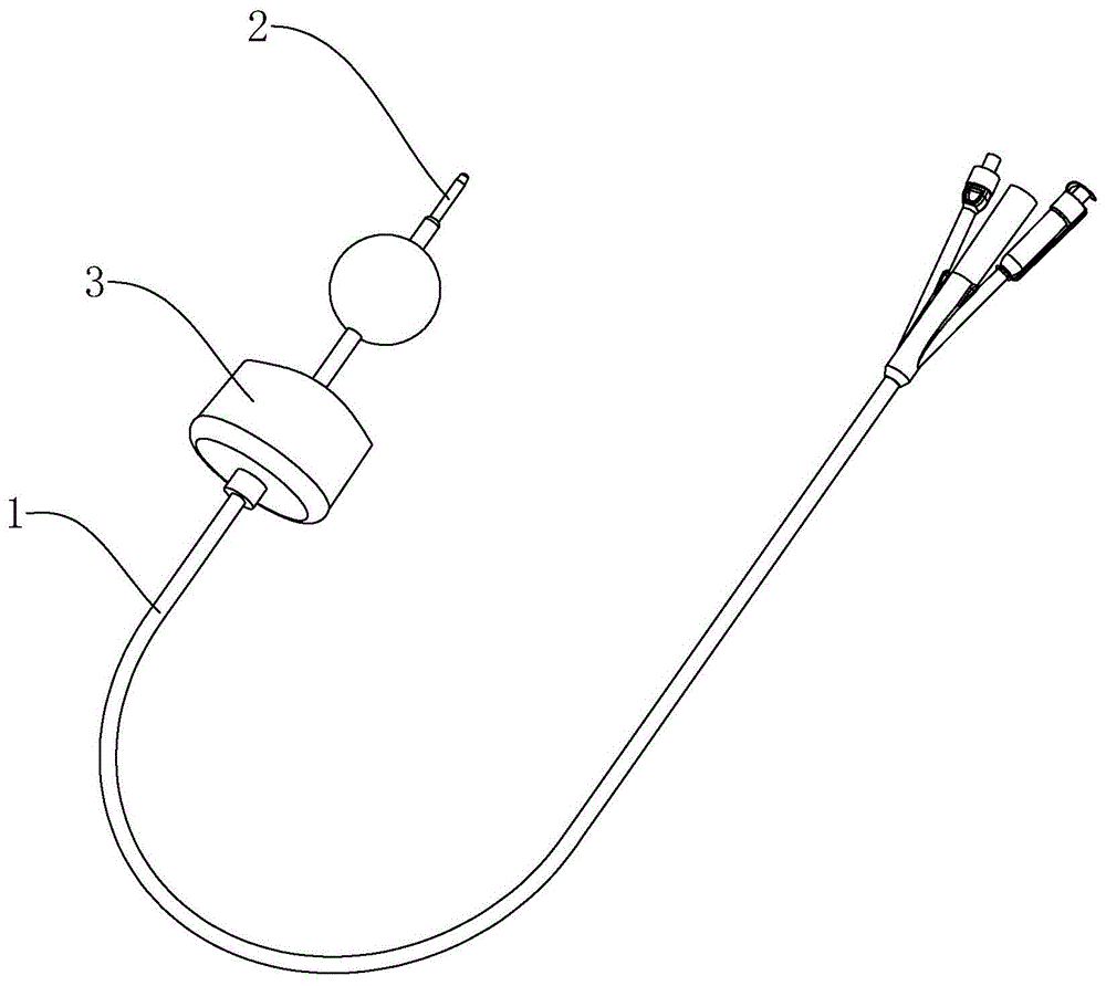 一种防堵塞三腔导尿管