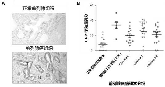 依法韦仑在制备治疗前列腺癌的药物中的应用的制作方法