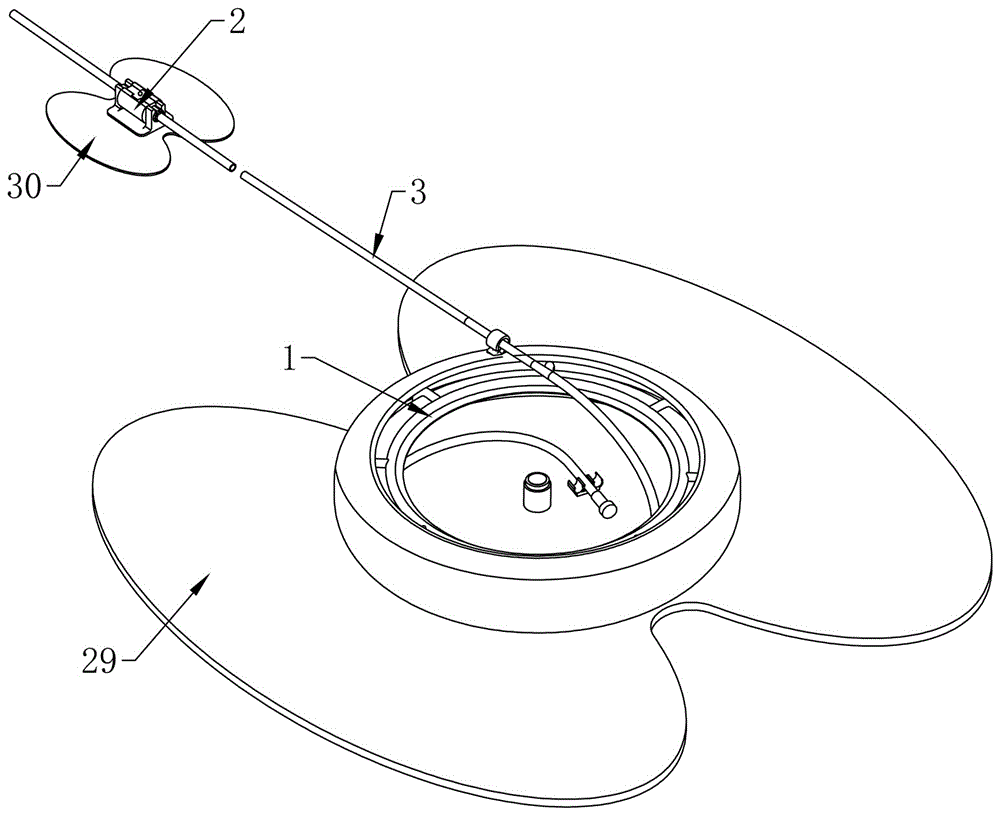 颈静脉溶栓导管螺旋盘绕式收纳及置管快速固定装置