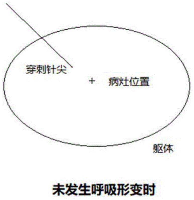 用于体内目标定位的数据处理方法、模块与系统与流程