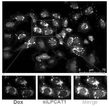 负载Dox及siLPCAT1的蛋黄脂质纳米药物及其制备方法和应用与流程