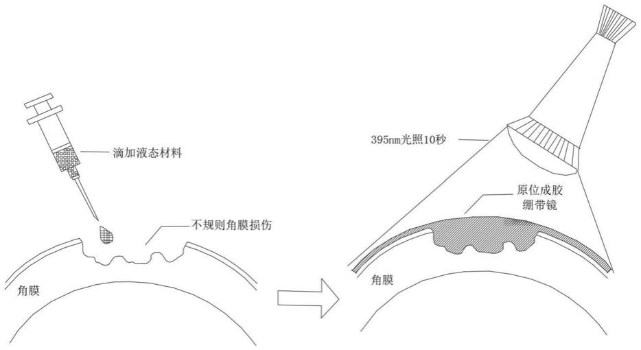 一种原位成胶个体化配适的角膜绷带镜