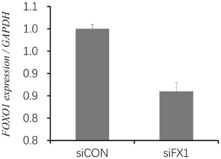 一种抑制FOXO1基因表达的特异性siRNA（siFX1）及其应用