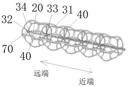 一种直径与长度可调控的取栓装置