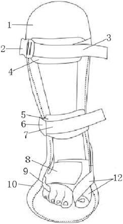 托玛琳矫正器的制作方法