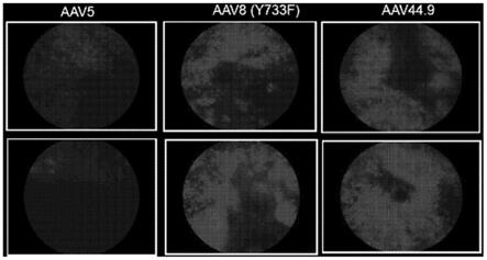 通过合理设计增强的新型AAV病毒在视网膜中的高效转导和侧向扩散