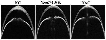 长链非编码RNA-NEAT1的应用及过表达RNA-NEAT1的腺相关病毒及应用