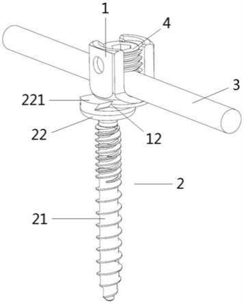 椎弓根螺钉及具有该螺钉的脊柱内固定系统的制作方法