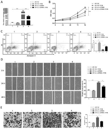 逆转录转座基因L1-ATP8B1及其作为肺鳞癌标志物的用途和治疗肺鳞癌的药物