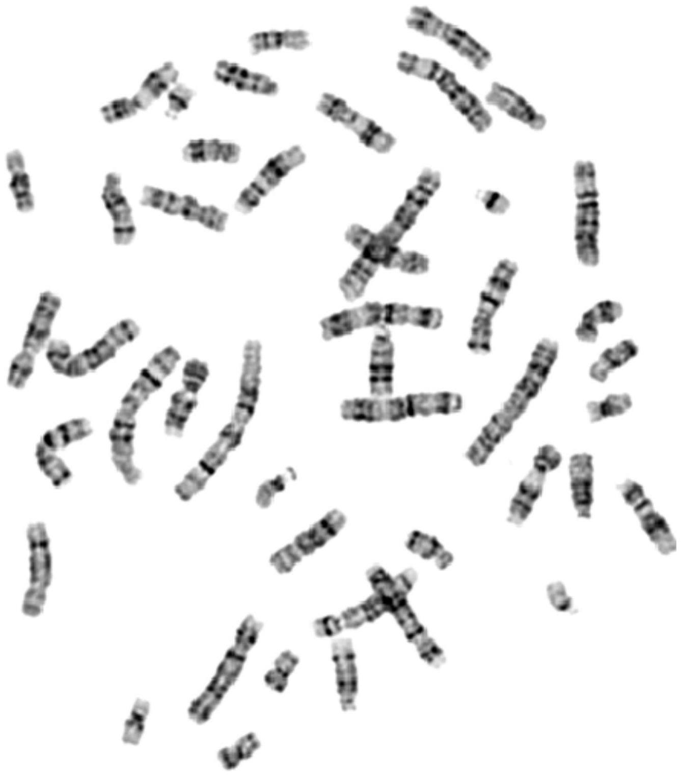 染色体核型分析模拟数据集的构建方法、构建装置、设备及存储介质与流程