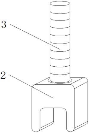 以美学和修复为导向的3D数字化种植导板的制作方法